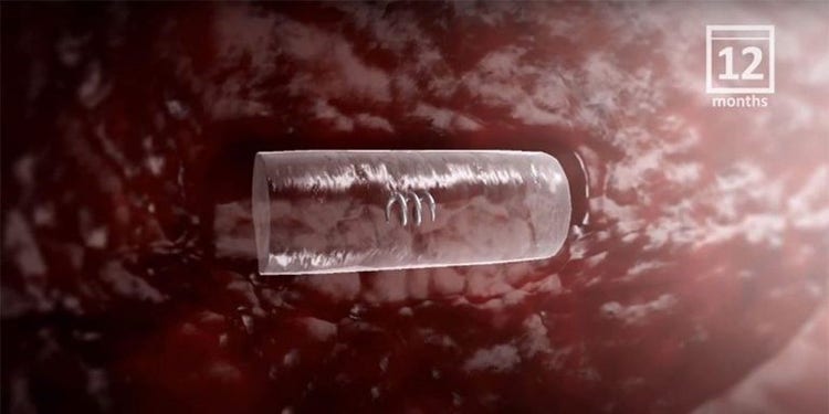 Watch the animation showing the HydroMARK™