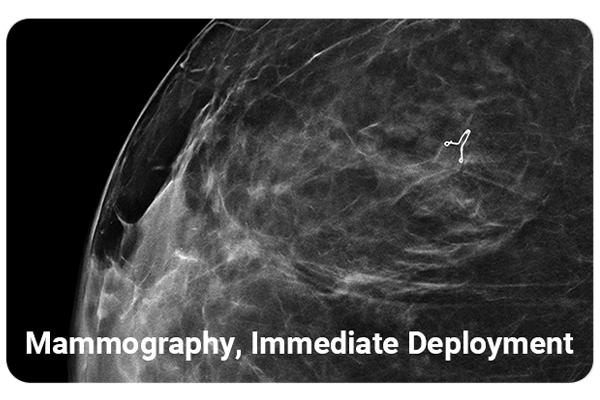 mammography image of Hydromark plus immediately after deployment