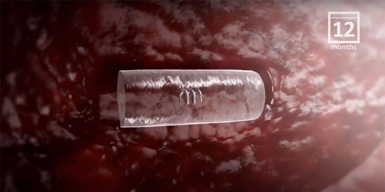 Watch the animation showing the HydroMARK™