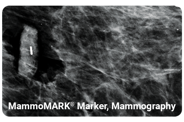 Hemostatic support of Mammotome Markers