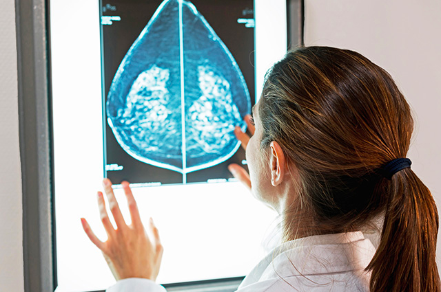 Physician reviews the results of a mammogram