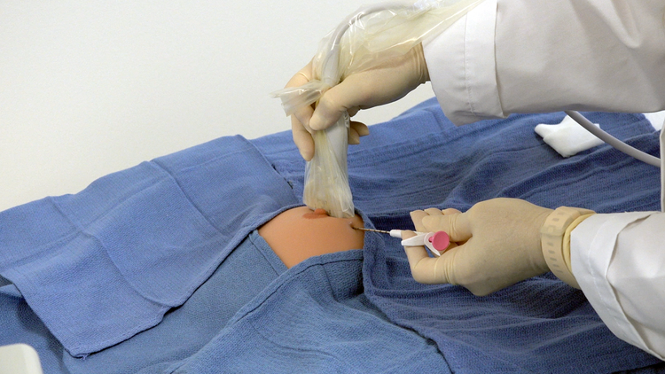 Watch physicians practice deploying the HydroMARK™ Plus marker under ultrasound