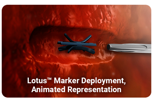 LumiMARK marker Lotus clip deployment illustration