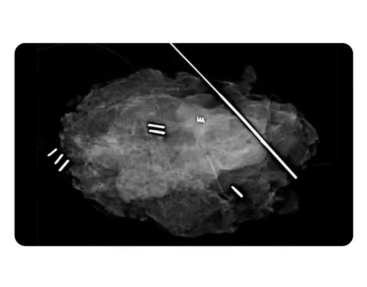 XPERT 40 image of tissue sample