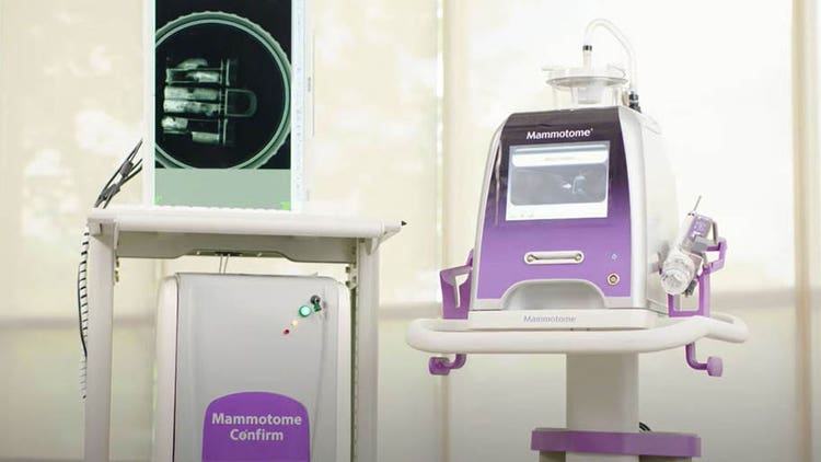 Watch the video to hear from experts how the Mammotome Revolve™ Biopsy System can help you Rethink Stereo Biopsy Efficiency