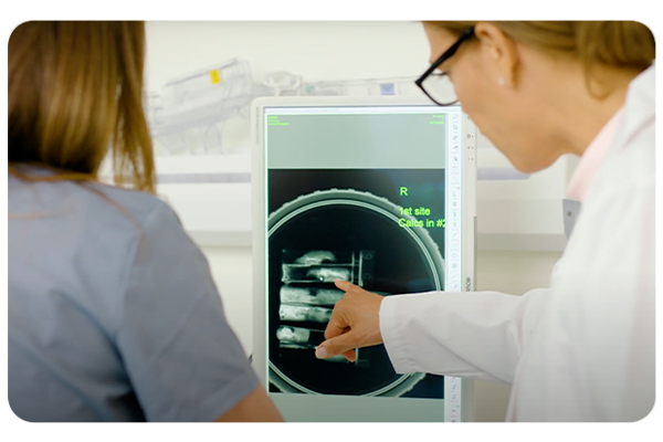 Clinicians review biopsy samples on Mammotome Confirm