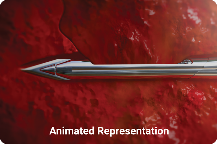 Animation of Mammotome Elite needle collecting tissue sample