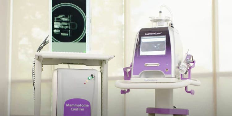 Watch the video to see how the Mammotome Confirm™ will allow you to rethink stereo biopsy efficiency