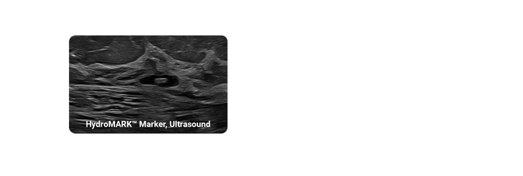 HydroMARK Marker features long-term ultrasound visibility