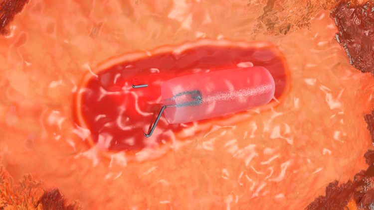 watch the hydromark plus animation