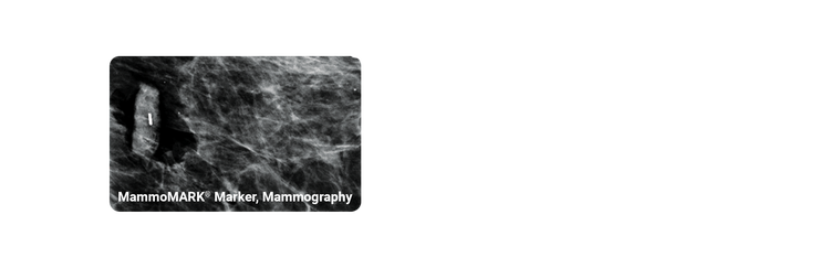MammoMARK marker under mammography